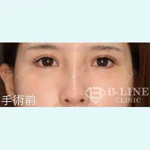 B-LINE CLINIC 池袋院 小池 康弘医師の症例