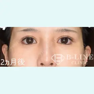 B-LINE CLINIC 池袋院 小池 康弘医師の症例