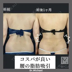 MYCLI【マイクリ】 本田マイケル武史医師の症例