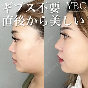 YBC横浜美容外科 大宮院 磯村 亮輔医師の症例