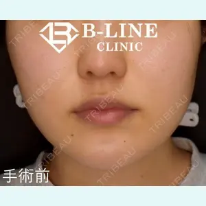 B-LINE CLINIC 池袋院 小池 康弘医師の症例