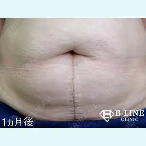 B-LINE CLINIC 池袋院 小池 康弘医師の症例