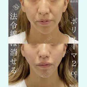 EMMO FACE CLINIC 大宮院 廣松 直樹医師の症例