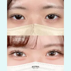 ASTRA BEAUTY CLINICの症例