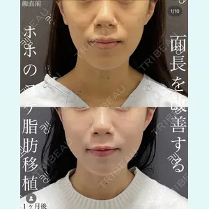 EMMO FACE CLINIC 大宮院 廣松 直樹医師の症例