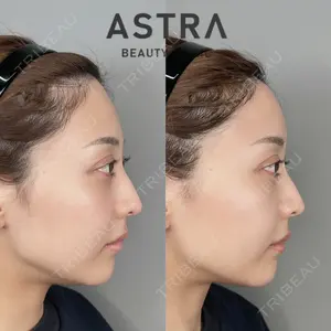 ASTRA BEAUTY CLINICの症例