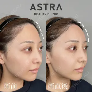 ASTRA BEAUTY CLINICの症例