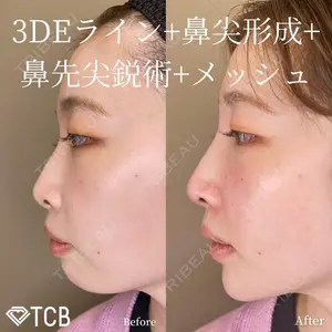 TCB東京中央美容外科 福島院の症例