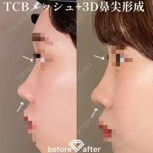 TCB東京中央美容外科 横浜院 森本 理一郎医師の症例
