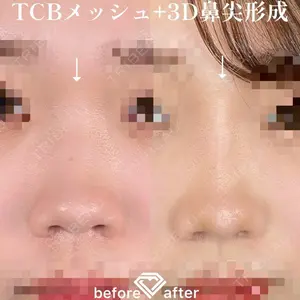 TCB東京中央美容外科 横浜院 森本 理一郎医師の症例