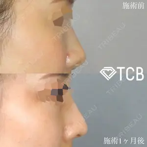 TCB東京中央美容外科 岡山院 佐藤 麻未医師の症例