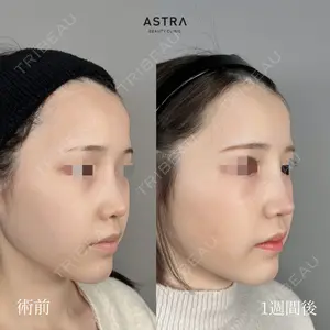 ASTRA BEAUTY CLINIC 塩満 惠子医師の症例