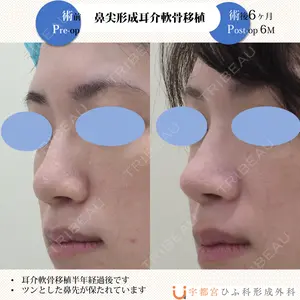 宇都宮ひふ科形成外科 宇都宮 裕己医師の症例