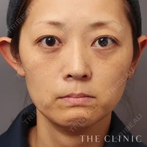 THE CLINIC（ザ・クリニック）東京院 大橋 昌敬医師の症例