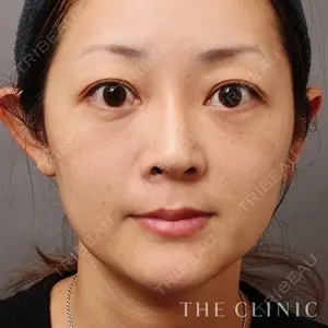 THE CLINIC（ザ・クリニック）東京院 大橋 昌敬医師の症例