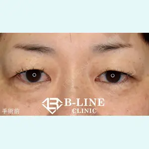 B-LINE CLINIC 池袋院 小池 康弘医師の症例