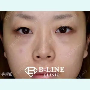 B-LINE CLINIC 池袋院 小池 康弘医師の症例