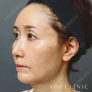 THE CLINIC（ザ・クリニック）東京院 加藤 敏次医師の症例