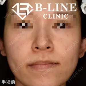 B-LINE CLINIC 池袋院 小池 康弘医師の症例