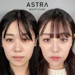 ASTRA BEAUTY CLINICの症例