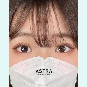 ASTRA BEAUTY CLINICの症例