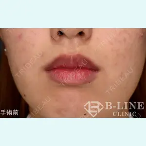 B-LINE CLINIC 池袋院 小池 康弘医師の症例