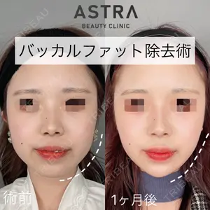 ASTRA BEAUTY CLINICの症例