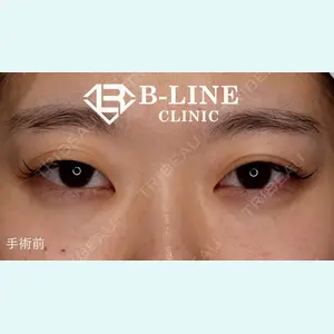 B-LINE CLINIC 池袋院 小池 康弘医師の症例