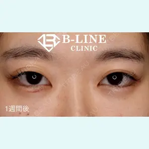 B-LINE CLINIC 池袋院 小池 康弘医師の症例