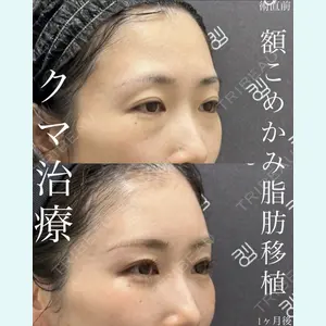 EMMO FACE CLINIC 大宮院 廣松 直樹医師の症例