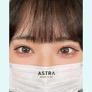 ASTRA BEAUTY CLINICの症例