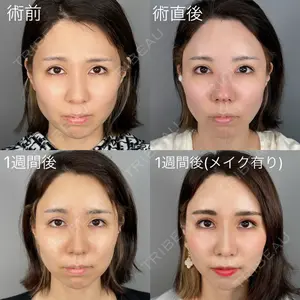 ASTRA BEAUTY CLINICの症例