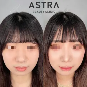 ASTRA BEAUTY CLINICの症例