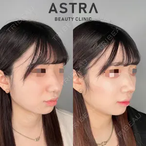 ASTRA BEAUTY CLINICの症例