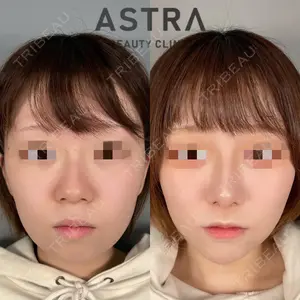 ASTRA BEAUTY CLINICの症例