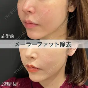 ブルームクリニック（BLOOM CLINIC） 大西 雅樹医師の症例