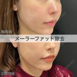 ブルームクリニック（BLOOM CLINIC） 大西 雅樹医師の症例