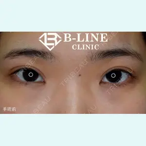 B-LINE CLINIC 池袋院 小池 康弘医師の症例