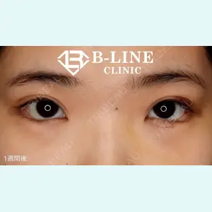 B-LINE CLINIC 池袋院 小池 康弘医師の症例