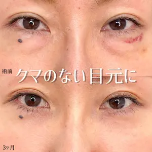 東京シンデレラ美容外科 池袋院の症例