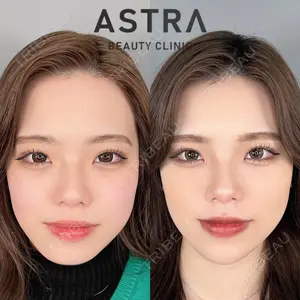 ASTRA BEAUTY CLINICの症例