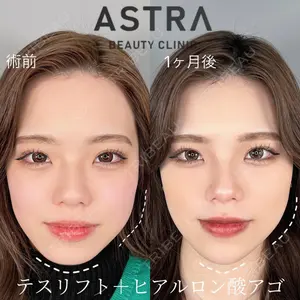 ASTRA BEAUTY CLINICの症例