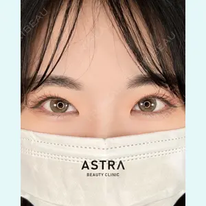 ASTRA BEAUTY CLINICの症例