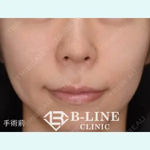 B-LINE CLINIC 池袋院 小池 康弘医師の症例