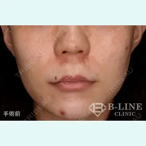 B-LINE CLINIC 池袋院 小池 康弘医師の症例