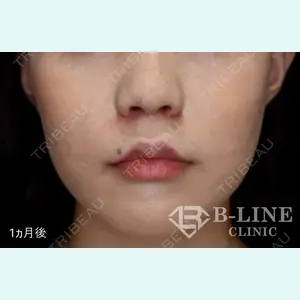 B-LINE CLINIC 池袋院 小池 康弘医師の症例