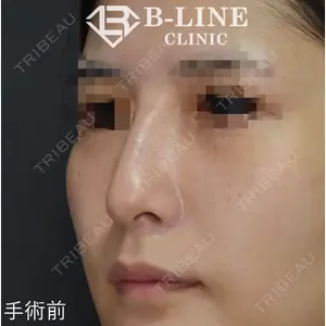 B-LINE CLINIC 池袋院 小池 康弘医師の症例