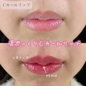 ルラ美容クリニック 渋谷本院の症例