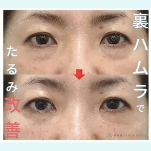 WOM CLINIC GINZA （ワム クリニック ギンザ）の症例