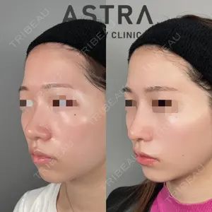 ASTRA BEAUTY CLINICの症例